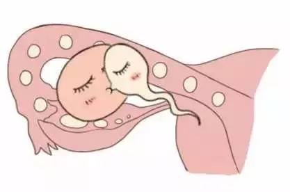 靠谱孕妈供卵代孕包生儿子